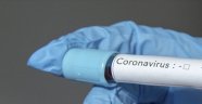 Türk halkına müjdeli haberi verdi: Koronavirüs tedavisi onaylandı