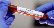 Avustralyalı ve İngiliz bilim insanları corona virüsün ilacını buldu